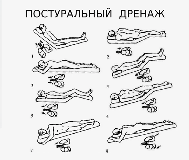 Техника постурального дренажа