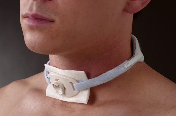 Если НИВЛ не эффективна, нужна инвазивная вентиляция через трахеостому