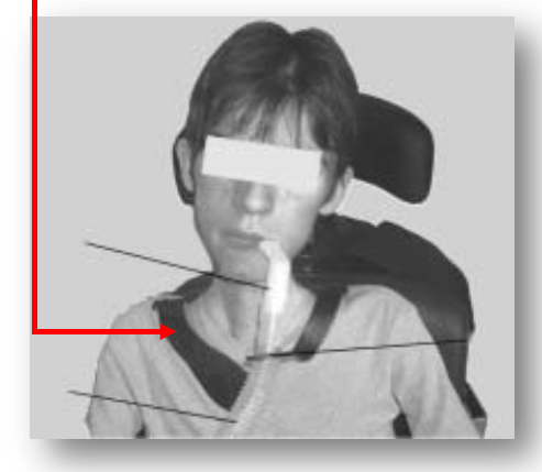 mpv-case-01.png